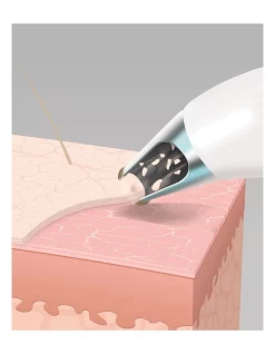 Best deal ๐คฉ Homedics Radiance Microdermabrasion With Cooling In White ๐ 14 Best deal ๐คฉ Homedics Radiance Microdermabrasion With Cooling In White ๐ -Philips Shop unnamed file 1300