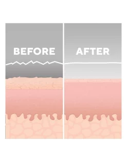 Best deal ๐คฉ Homedics Radiance Microdermabrasion With Cooling In White ๐ 15 Best deal ๐คฉ Homedics Radiance Microdermabrasion With Cooling In White ๐ -Philips Shop unnamed file 1301