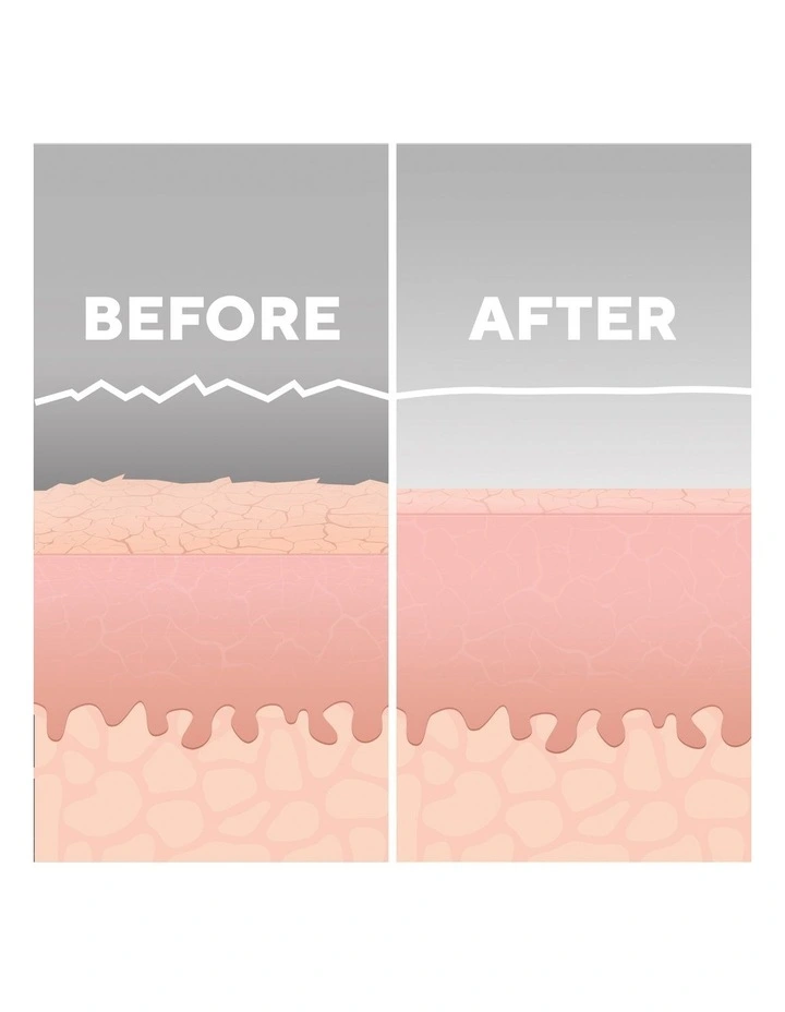 Best deal ๐คฉ Homedics Radiance Microdermabrasion With Cooling In White ๐ 9 Best deal ๐คฉ Homedics Radiance Microdermabrasion With Cooling In White ๐ - Image 7